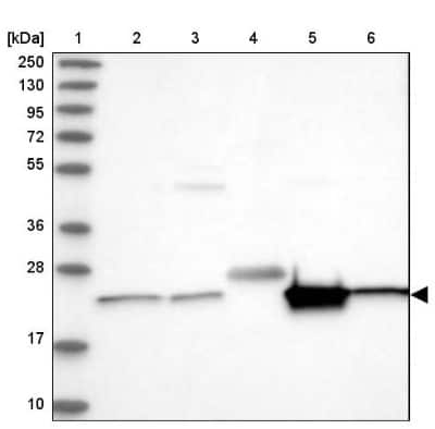 Western Blot: CDC123 Antibody [NBP1-88540]