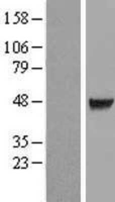 Western Blot: CDC123 Overexpression Lysate [NBL1-08987]