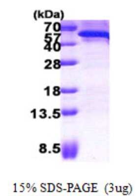 SDS-PAGE: Recombinant Human CDC123 His Protein [NBP2-22764]