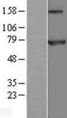 Western Blot: CDC16 Overexpression Lysate [NBL1-08989]