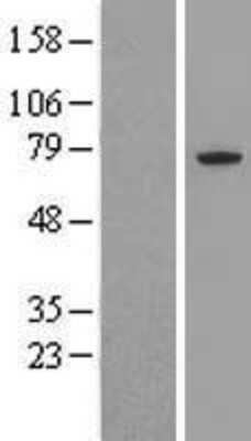 Western Blot: CDC16 Overexpression Lysate [NBL1-08990]