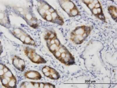 Immunohistochemistry-Paraffin: CDC2/CDK1 Antibody (1A4-1A9) [H00000983-M01]
