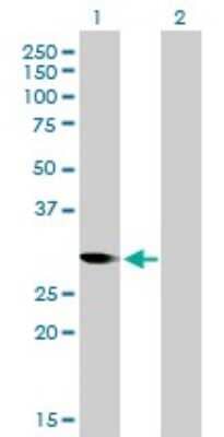 Western Blot: CDC2/CDK1 Antibody (1A4-1A9) [H00000983-M01]