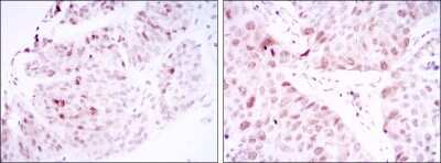 Immunohistochemistry-Paraffin: CDC2/CDK1 Antibody (2G9) - BSA Free [NBP2-37626]
