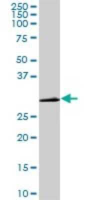 Western Blot: CDC2/CDK1 Antibody (8F1) [H00000983-M04]