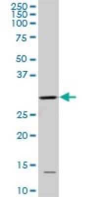 Western Blot: CDC2/CDK1 Antibody (8F1) [H00000983-M04]