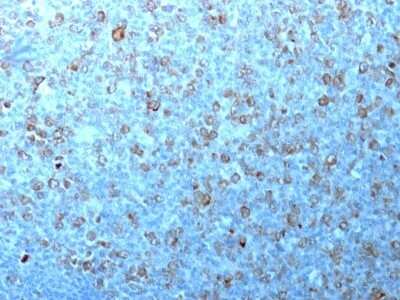Immunohistochemistry-Paraffin: CDC2/CDK1 Antibody (CDK1/873) [NBP2-44915]