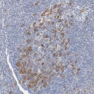 Immunohistochemistry-Paraffin: CDC2/CDK1 Antibody [NBP1-85729]