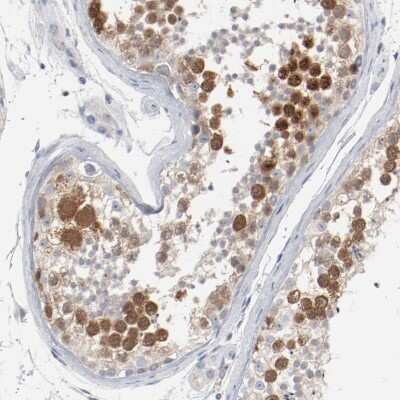 Immunohistochemistry-Paraffin: CDC2/CDK1 Antibody [NBP1-85729]
