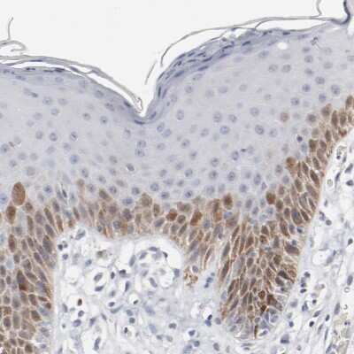 Immunohistochemistry-Paraffin: CDC2/CDK1 Antibody [NBP1-85729]