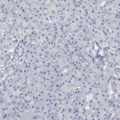 Immunohistochemistry-Paraffin: CDC2/CDK1 Antibody [NBP1-85729]