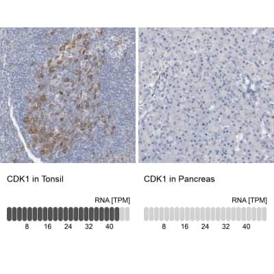 Immunohistochemistry-Paraffin: CDC2/CDK1 Antibody [NBP1-85729]