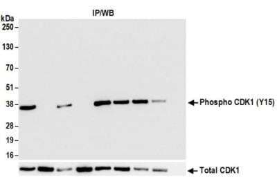 Immunoprecipitation: CDC2/CDK1 Antibody (BLR101H) [NBP3-14693]