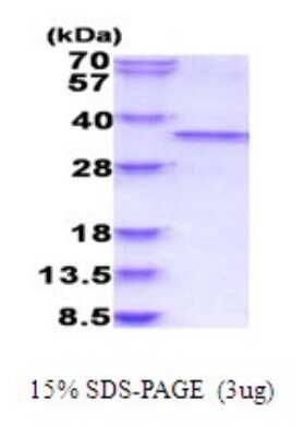 SDS-PAGE: Recombinant Human CDC2/CDK1 His Protein [NBP2-51886]