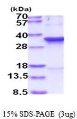 SDS-PAGE: Recombinant Human CDC2/CDK1 His Protein [NBP2-52017]