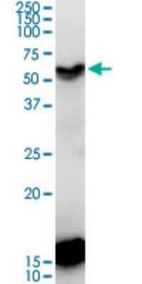 Western Blot: CDC20B Antibody (2F2) [H00166979-M11]