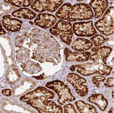 Immunohistochemistry: CDC20B Antibody [NBP2-31024]