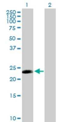 Western Blot: CDC20B Antibody [H00166979-B01P]