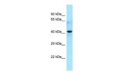 Western Blot: CDC20B Antibody [NBP2-87164]