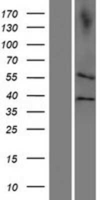 Western Blot: CDC20B Overexpression Lysate [NBP2-05333]