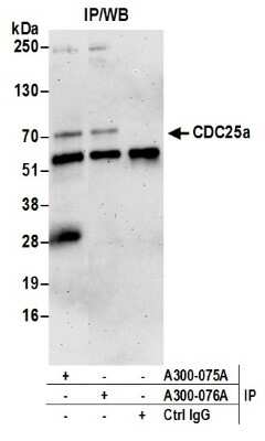 Western Blot: CDC25A Antibody [NB100-213]