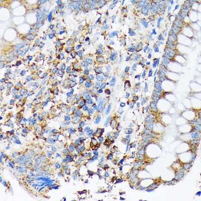 Immunohistochemistry-Paraffin: CDC25B Antibody (4D5S10) [NBP3-16877]