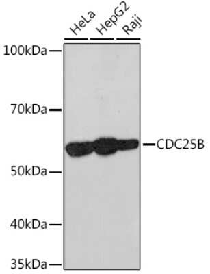 Western Blot: CDC25B Antibody (4D5S10) [NBP3-16877]