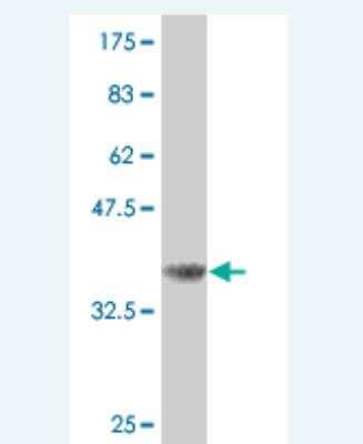 Western Blot: CDC25B Antibody (7E8) [H00000994-M01]