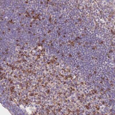 Immunohistochemistry: CDC25B Antibody [NBP2-32627]