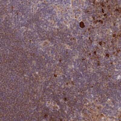 Immunohistochemistry-Paraffin: CDC25B Antibody [NBP2-32626]