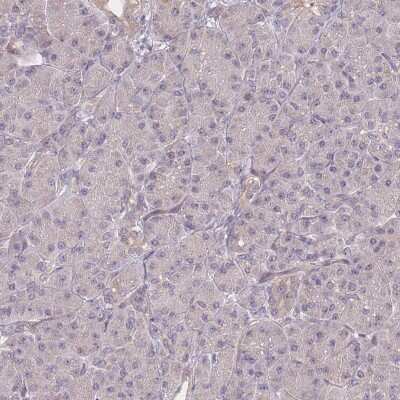 Immunohistochemistry-Paraffin: CDC25B Antibody [NBP2-32626]