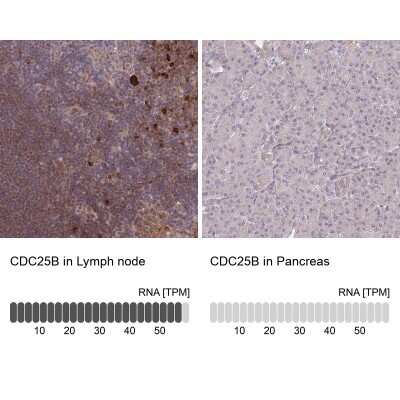 Immunohistochemistry-Paraffin: CDC25B Antibody [NBP2-32626]