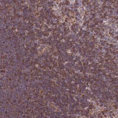 Immunohistochemistry-Paraffin: CDC25B Antibody [NBP2-32627]