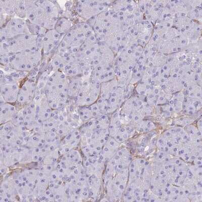 Immunohistochemistry-Paraffin: CDC25B Antibody [NBP2-32627]