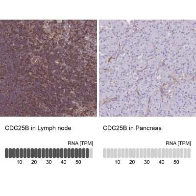 Immunohistochemistry-Paraffin: CDC25B Antibody [NBP2-32627]