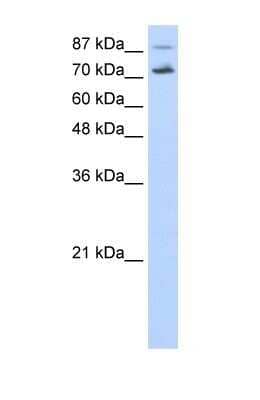 Western Blot: CDC25B Antibody [NBP1-58076]