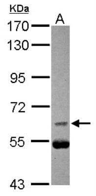 Western Blot: CDC25B Antibody [NBP2-15826]