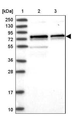 Western Blot: CDC25B Antibody [NBP2-32626]