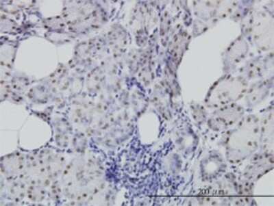 Immunohistochemistry-Paraffin: CDC25C Antibody (3B11) [H00000995-M01]