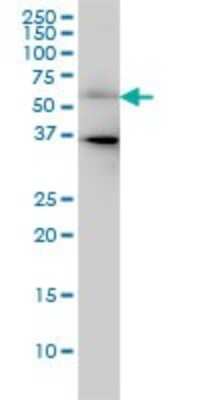 Western Blot: CDC25C Antibody (3B11) [H00000995-M01]