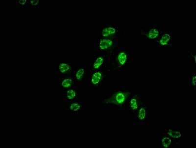 Immunocytochemistry/ Immunofluorescence: CDC25C Antibody (3E6) [NBP3-15178]