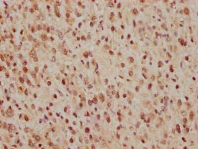 Immunohistochemistry: CDC25C Antibody (3E6) [NBP3-15178]