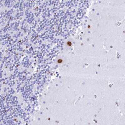 Immunohistochemistry-Paraffin: CDC26 Antibody [NBP1-91771]