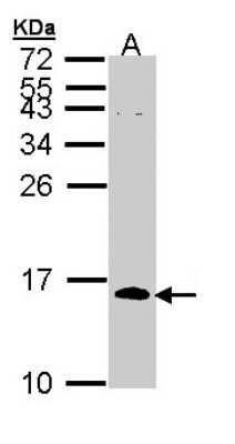 Western Blot: CDC26 Antibody [NBP1-33112]