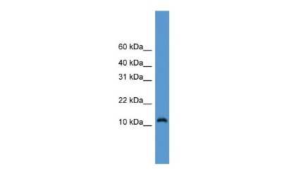 Western Blot: CDC26 Antibody [NBP2-84639]