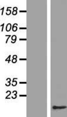 Western Blot: CDC26 Overexpression Lysate [NBL1-08997]