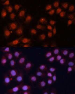 Immunocytochemistry/ Immunofluorescence: CDC2L1 Antibody - Azide and BSA Free [NBP2-92609]