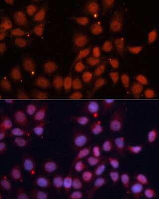 Immunocytochemistry/ Immunofluorescence: CDC2L1 Antibody - Azide and BSA Free [NBP3-03256]