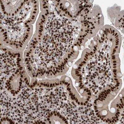 Immunohistochemistry-Paraffin: CDC2L2 Antibody [NBP1-85726]