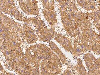 Immunohistochemistry-Paraffin: CDC2L1 Antibody [NBP3-06170]